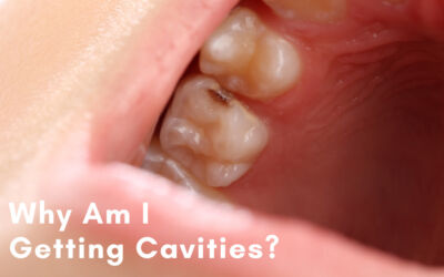 Why am I getting Cavities?