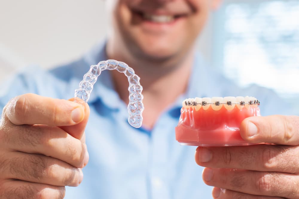 Invisalign Compared to Braces