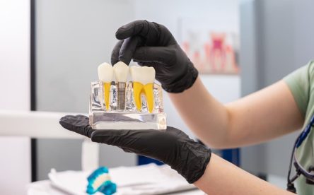 How Dental Implants Can Prevent Bone Loss at Glandwr Dental Practice