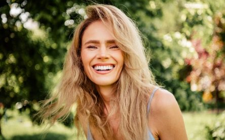 How to Maintain Results After a Smile Makeover